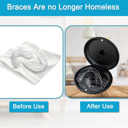 2 Pack Aligner and Retainer Case,  Slim Aligner Case Compatible with Invisalign, Mouth Guard Case, Orthodontic Case, Teeth Braces Case, Night Guard Case Container Storage Holder Black.